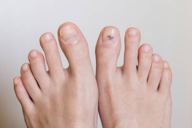 Healthy Feet & Nails